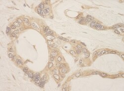 CASC3 Antibody, Novus Biologicals 0.1mL; Unlabeled:Antibodies, Polyclonal